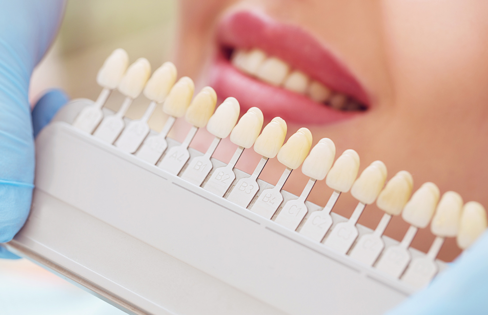 Cosmetic Dentistry Questions